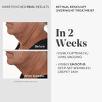 Murad Retinal ReSculpt Overnight Treatment Serum packaging close up.