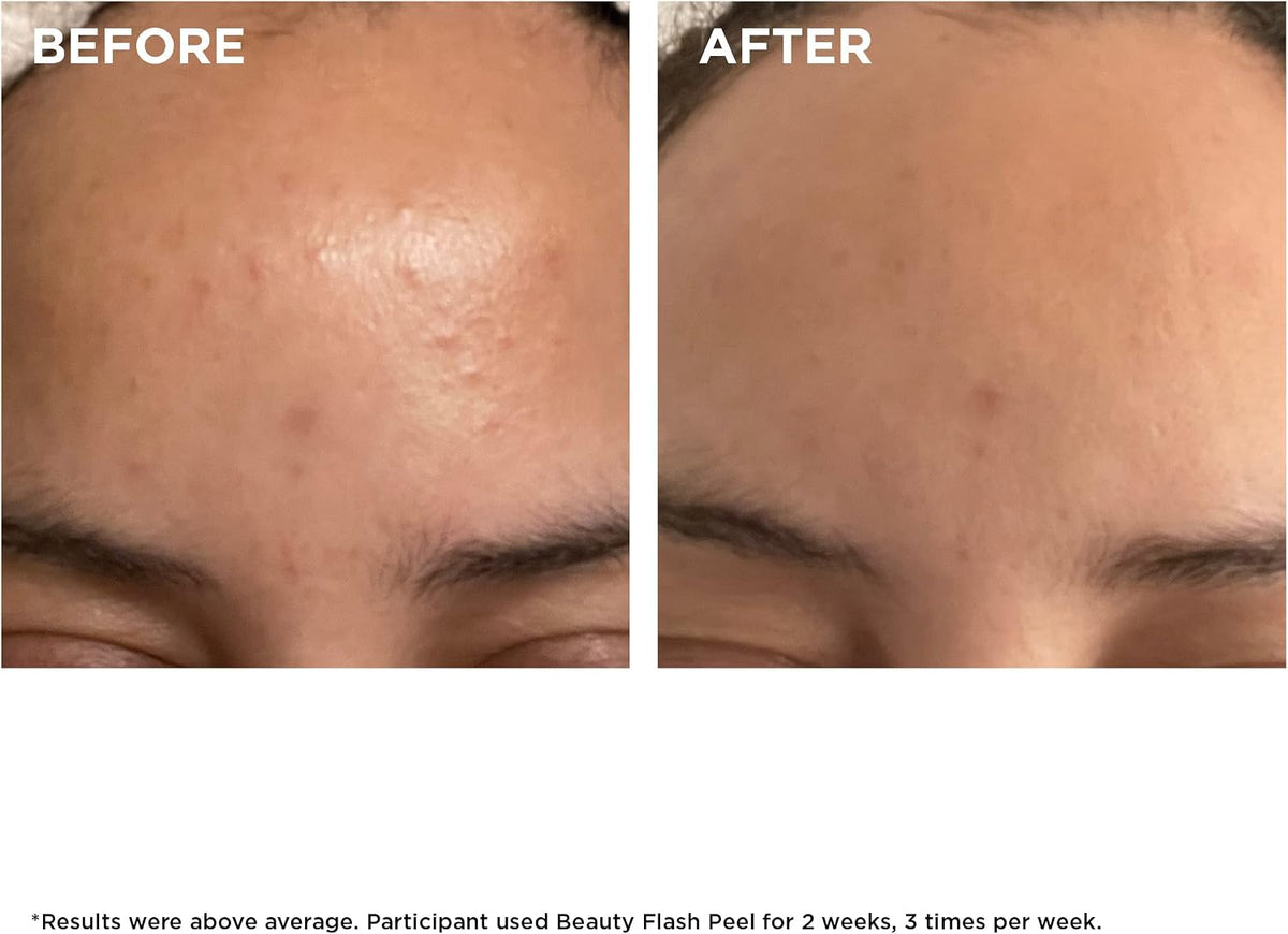 Clarins Beauty Flash Peel texture and liquid gel swatch