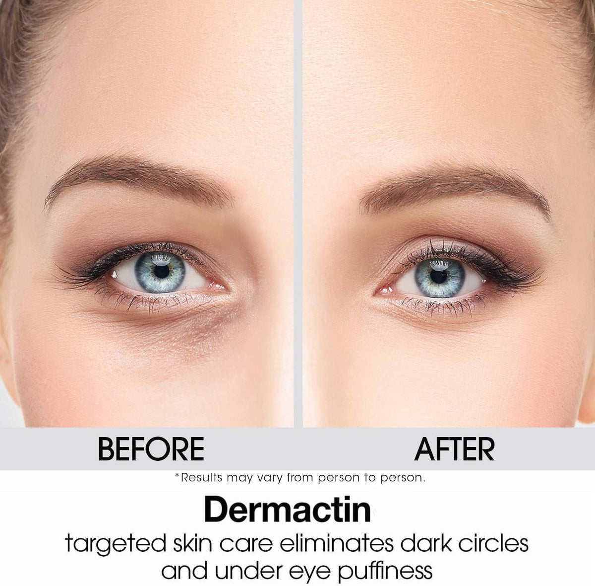 Dermactin Upper Eyelid Cream 1 oz. Firms & Tones Sagging & Drooping Skin On Upper Eye Lids, for Younger, More Vibrant & Alert Appearance, for Sensitive Skin In The Eyelids - Image 8