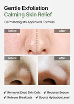 Packaging details of Celimax Korean exfoliating facial peels for troubled skin and breakouts.