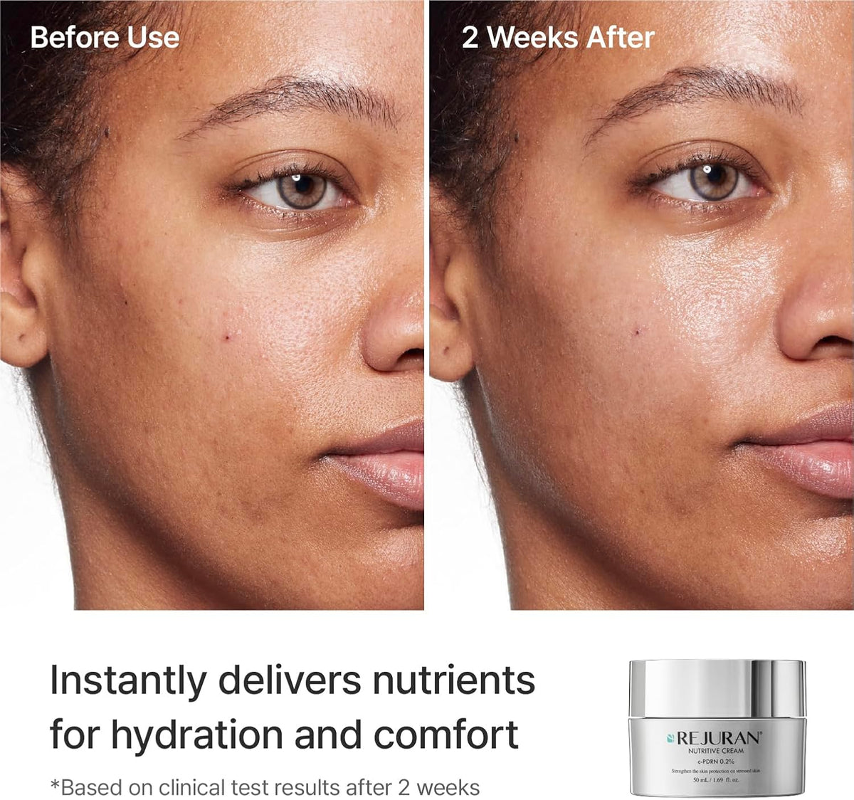 Rejuran Nutritive Cream texture demonstration on skin