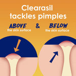 Clearasil 6.78 fluid ounce acne treatment wash back label
