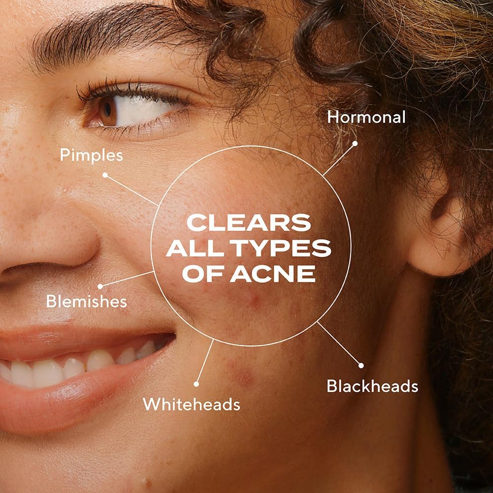 Murad phytosteroid deep relief spot treatment for blemishes