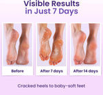 Bloomora exfoliating foot socks pouch design