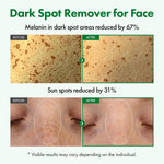 Texture shot of the lightweight Korean hyperpigmentation serum absorbing quickly into the skin.