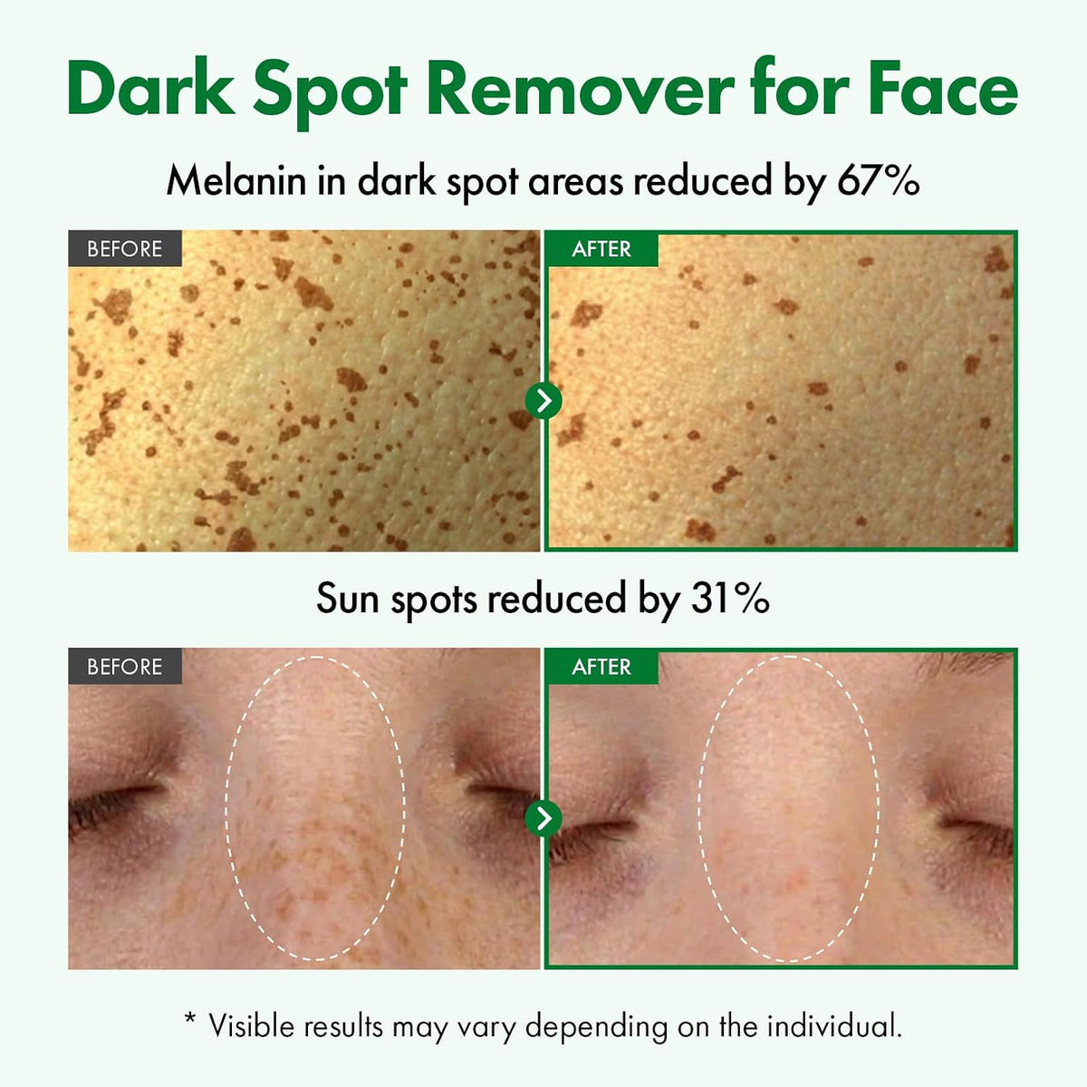 Texture shot of the lightweight Korean hyperpigmentation serum absorbing quickly into the skin.