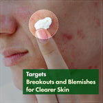 TOSOWOONG Azelaic Acid Ten Percent Face Serum bottle highlighting the green-tinted formula for rosacea care.