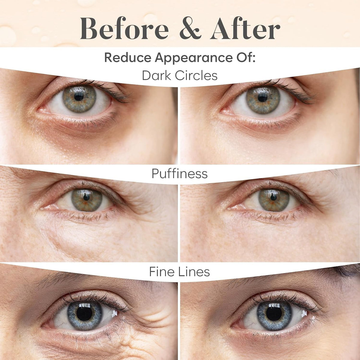 Model wearing Bloomora caffeine under eye gel patches