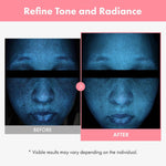 Tosowoong face moisturizer with niacinamide for uneven skin tone care.