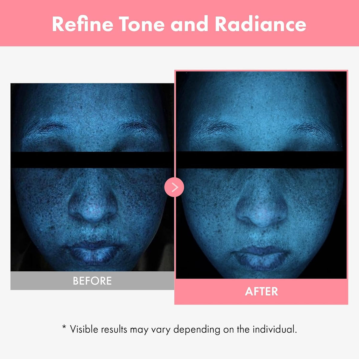 Authentic imported TOSOWOONG skincare packaging demonstrating the complete glass skin radiance kit.