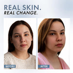 Model demonstrating application of ThriveCo Vitamin C Serum on face