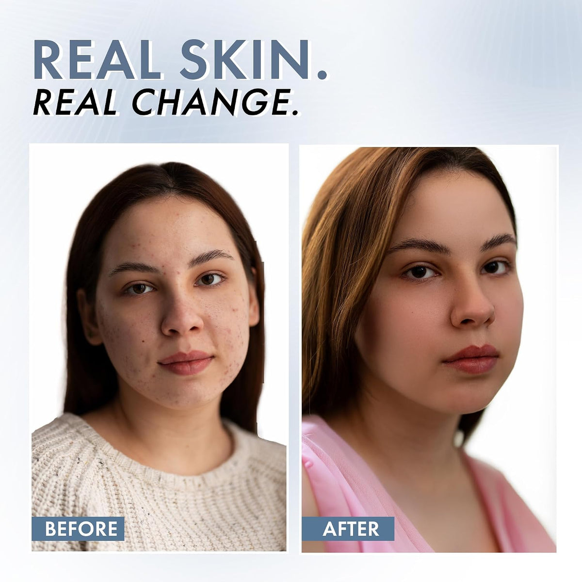 Model demonstrating application of ThriveCo Vitamin C Serum on face