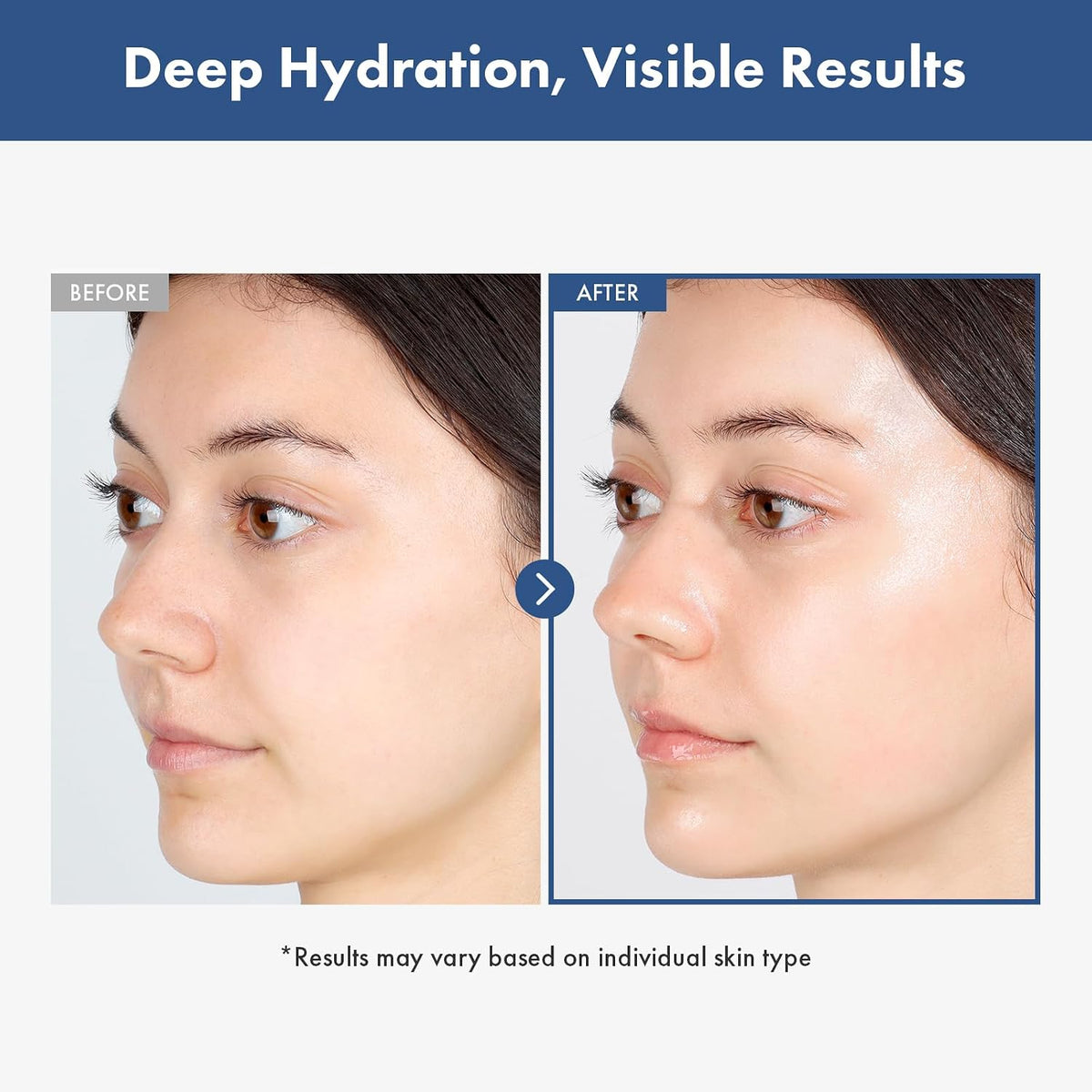 Korean skincare routine products for dark spot removal and hydration