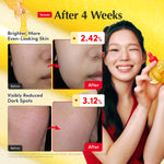 Eqqualberry Korean skincare set active ingredients graphic display
