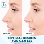 BLOOMORA Nose Pore Strips ingredient highlights