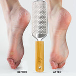 Stainless steel grater surface of foot rasp for dead skin