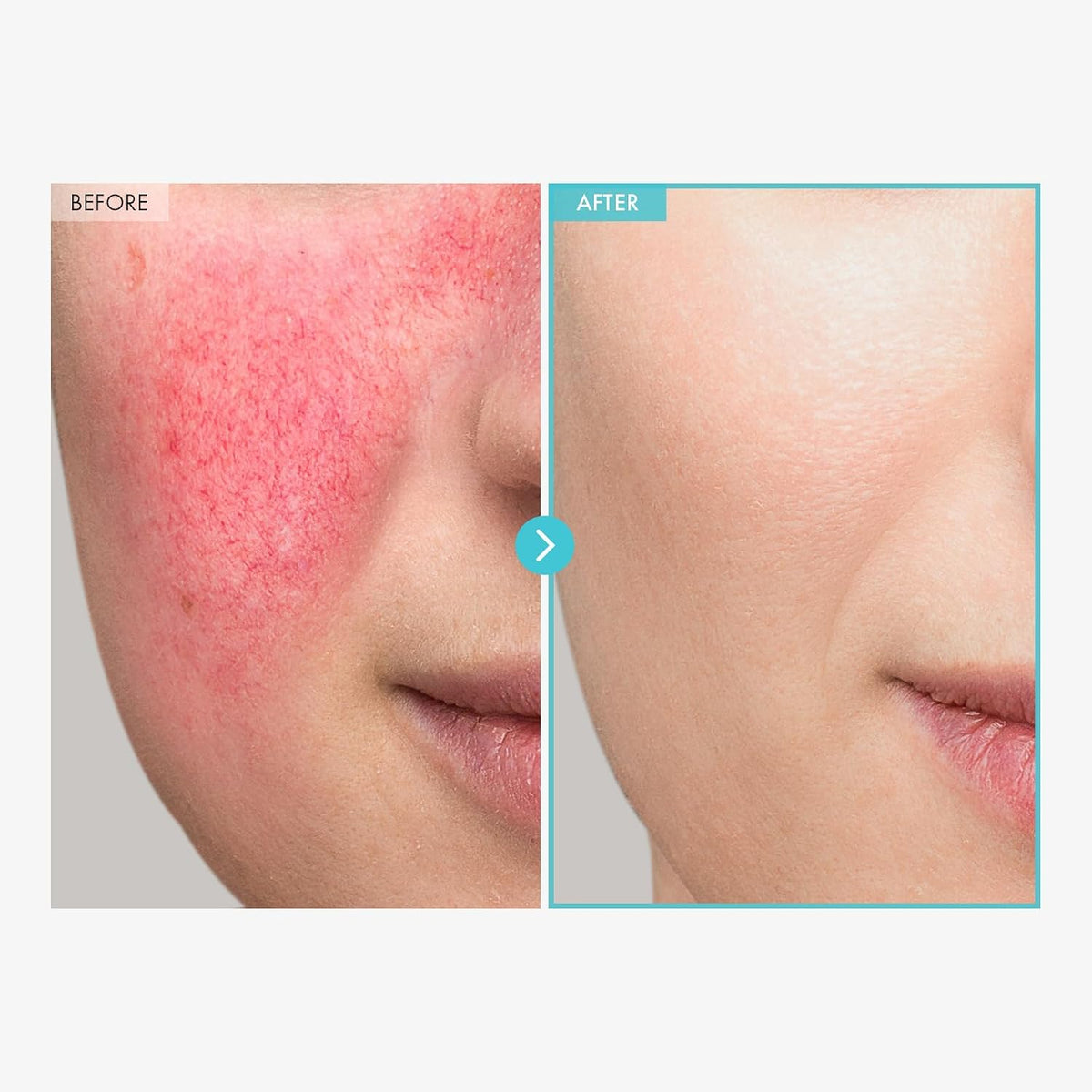 Side view of Tosowoong Korean skincare zinc cream 50 grams