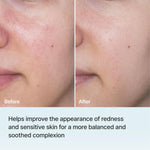 Korean skincare Rejuran mask for skin barrier repair
