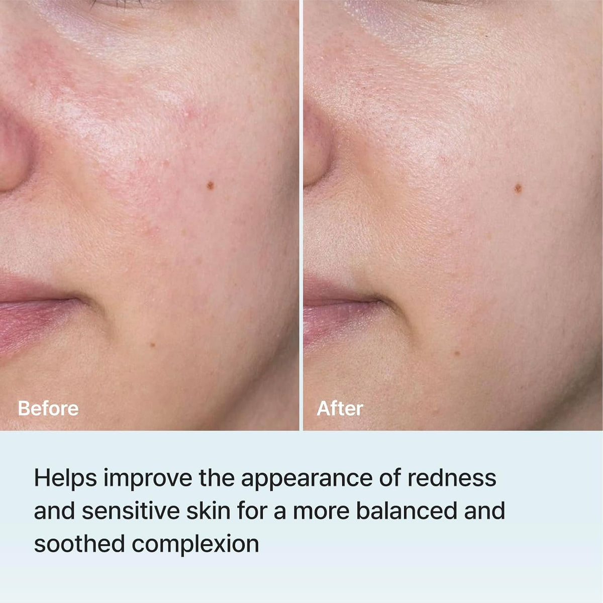 Korean skincare Rejuran mask for skin barrier repair