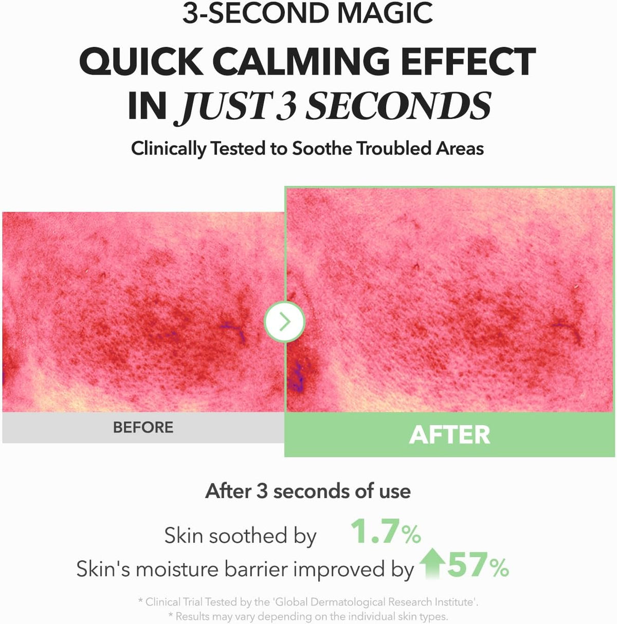 APRILSKIN Mugwort and Centella leaf water serum for redness