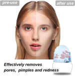 Foredawn skin tightening ice roller open view