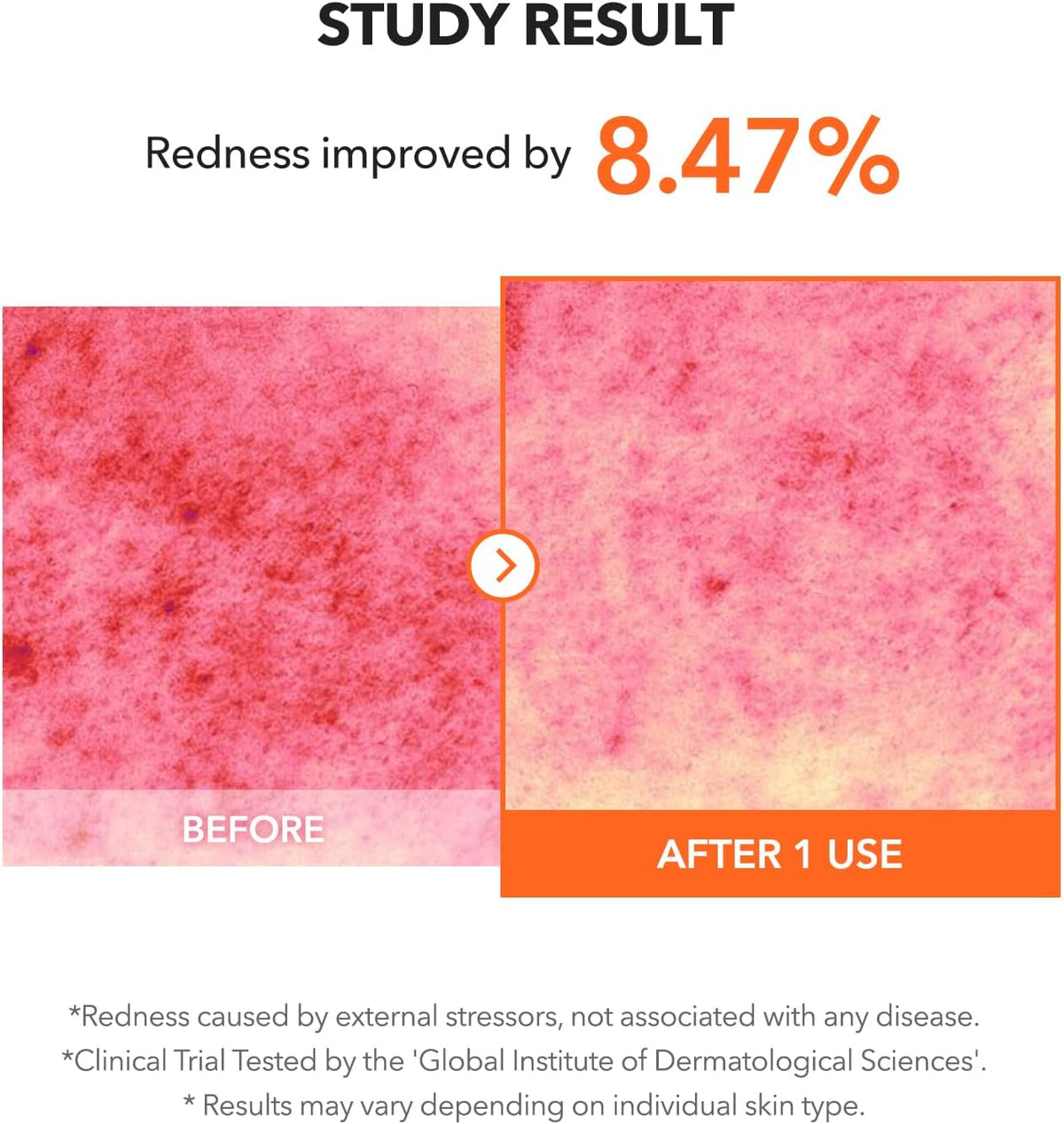 Texture preview of the lightweight APRILSKIN Carrotene blemish solution alongside the intensive cooling sheet mask sheet.