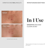 Murad blemish control body pads with salicylic acid for clearing breakouts