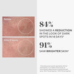 Murad glycolic acid skin brightening serum dropper view
