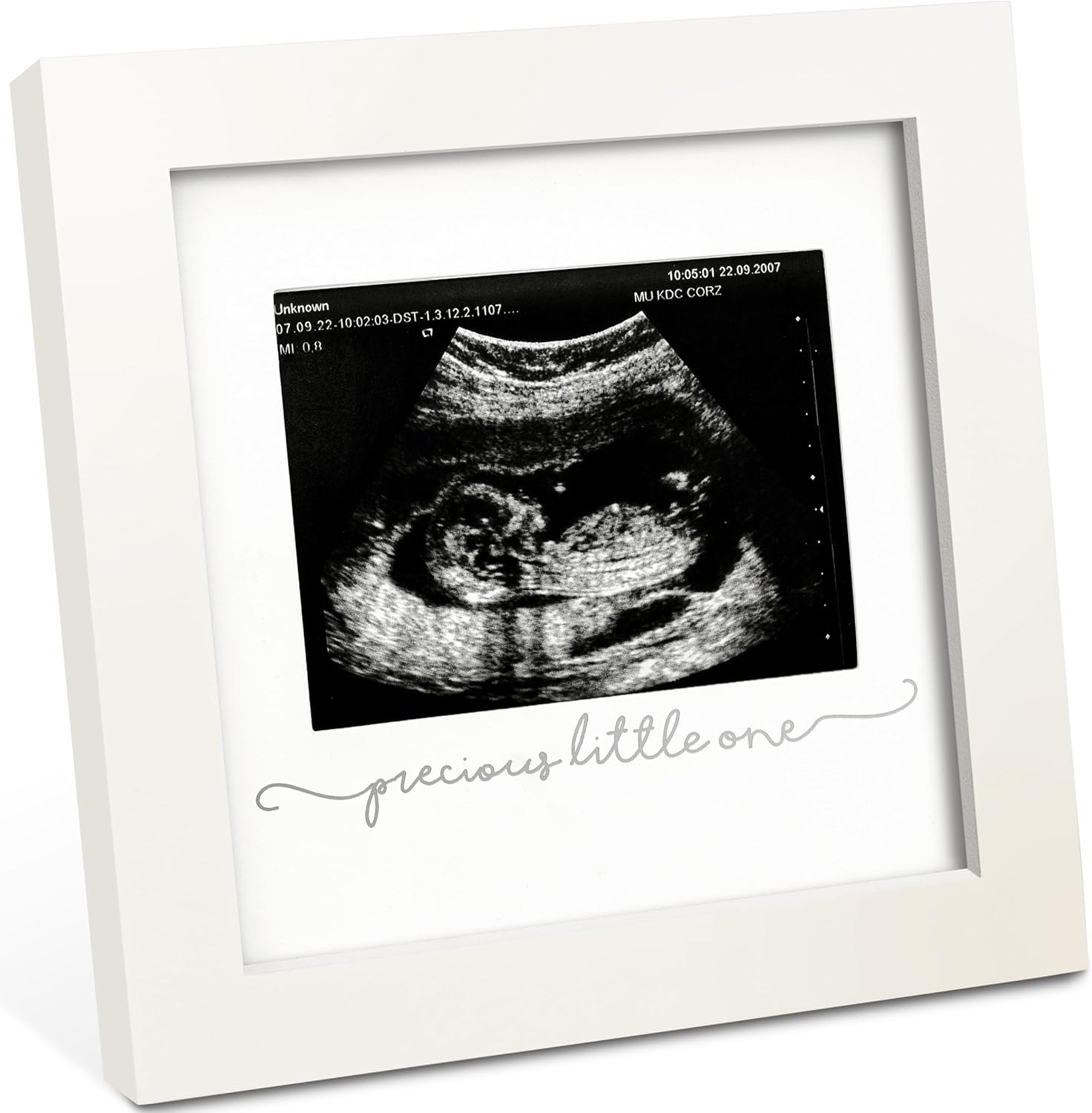 KeaBabies Baby Sonogram Picture Frame front view showcasing the alpine white wooden finish and real glass cover.