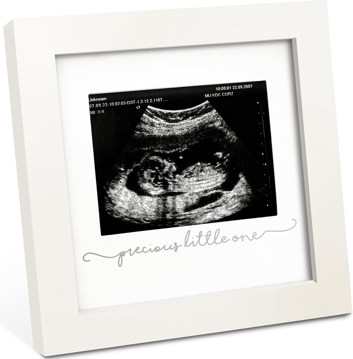 KeaBabies Baby Sonogram Picture Frame front view showcasing the alpine white wooden finish and real glass cover.
