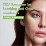 TOSOWOONG daily soothing moisturizer for breakouts and facial redness