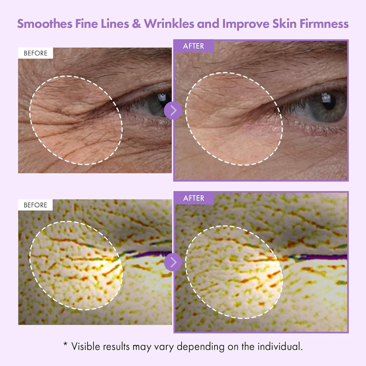 TOSOWOONG Korean retinol alternative face moisturizer texture showing micro capsules