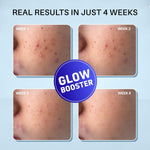 DermDoc Glow Fusion Night Cream applied on skin model