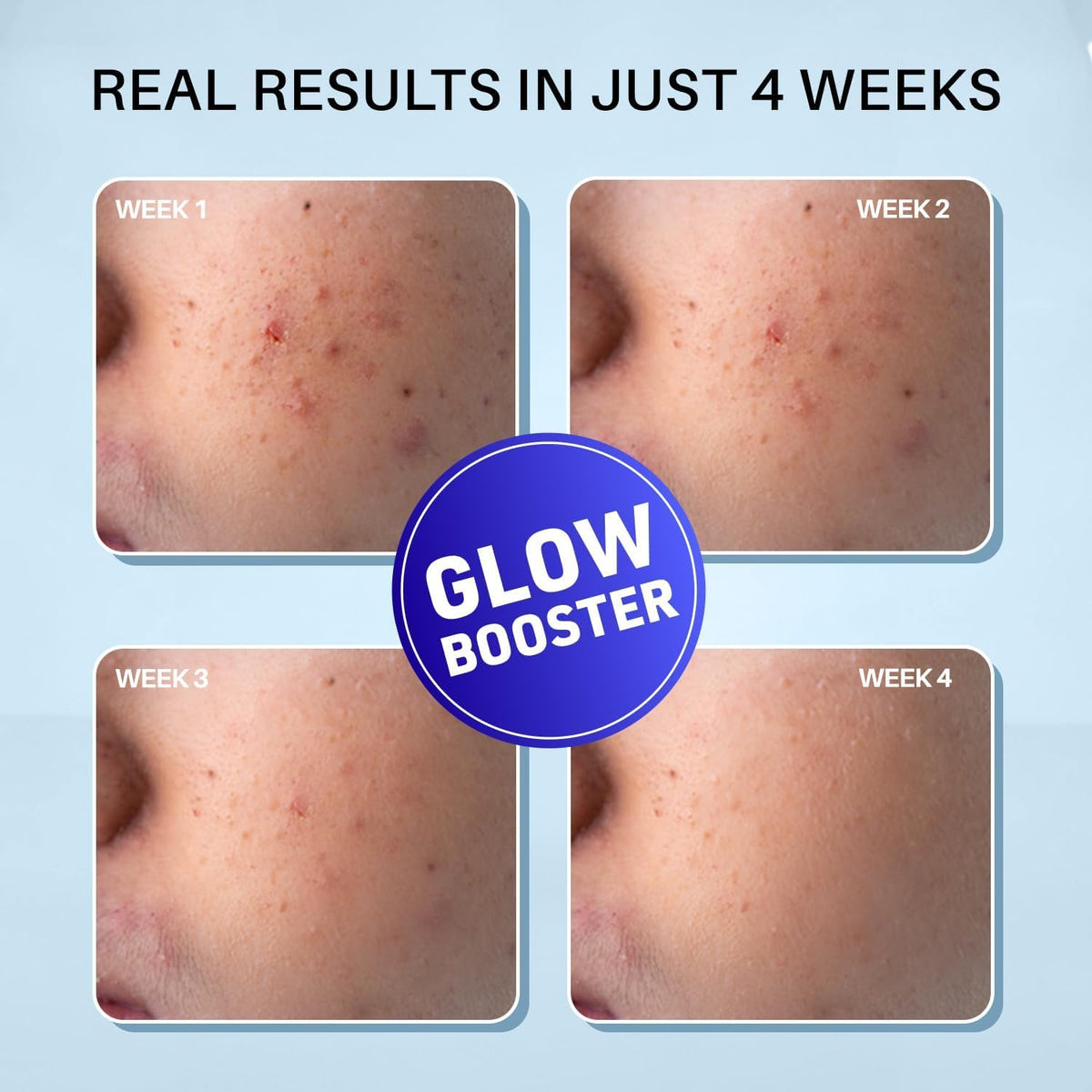 DermDoc Glow Fusion Night Cream applied on skin model