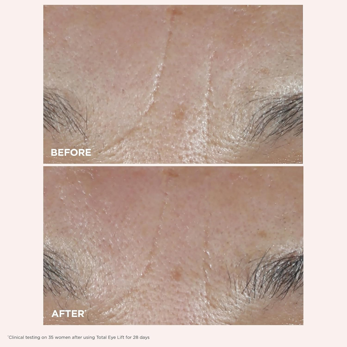 Clarins Total Eye Lift luxury skincare product branding and label