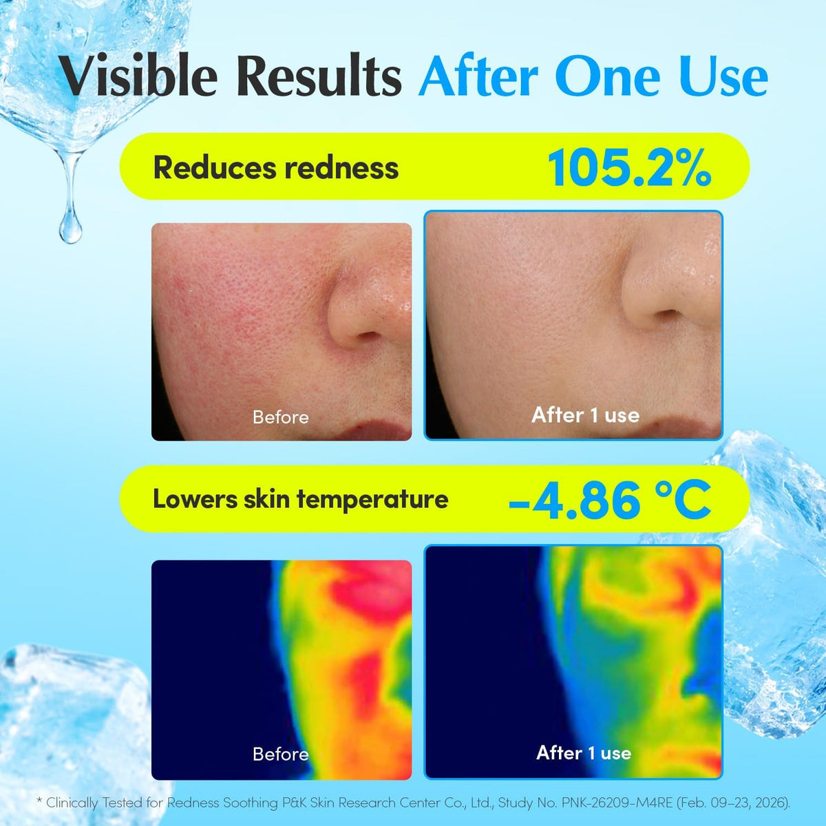 Eqqualberry Hyaltoin Flooding Cream application on face