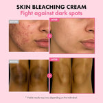 Korean skincare dark spot remover cream tube displayed on a clean background for daily routine.