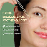 Lightweight non sticky texture of Tosowoong Madagascar Centella serum being applied to the skin.