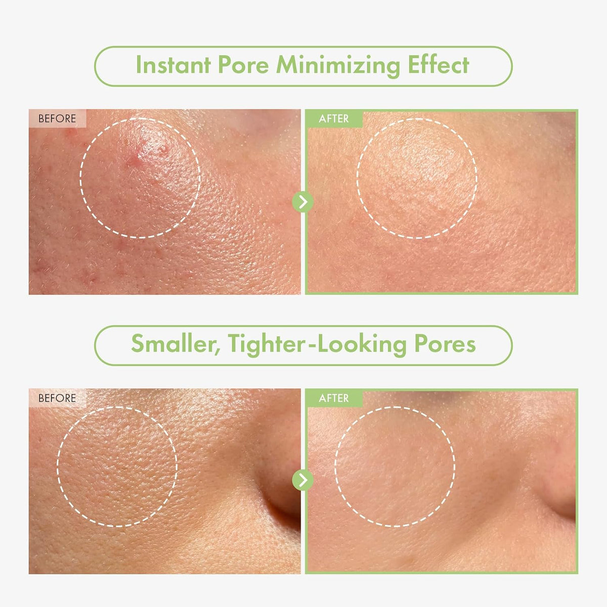 Complete packaging layout of the imported TOSOWOONG K-beauty skincare set for enlarged pores.