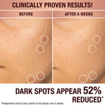 Charlotte Tilbury skincare serum for dark spots and redness