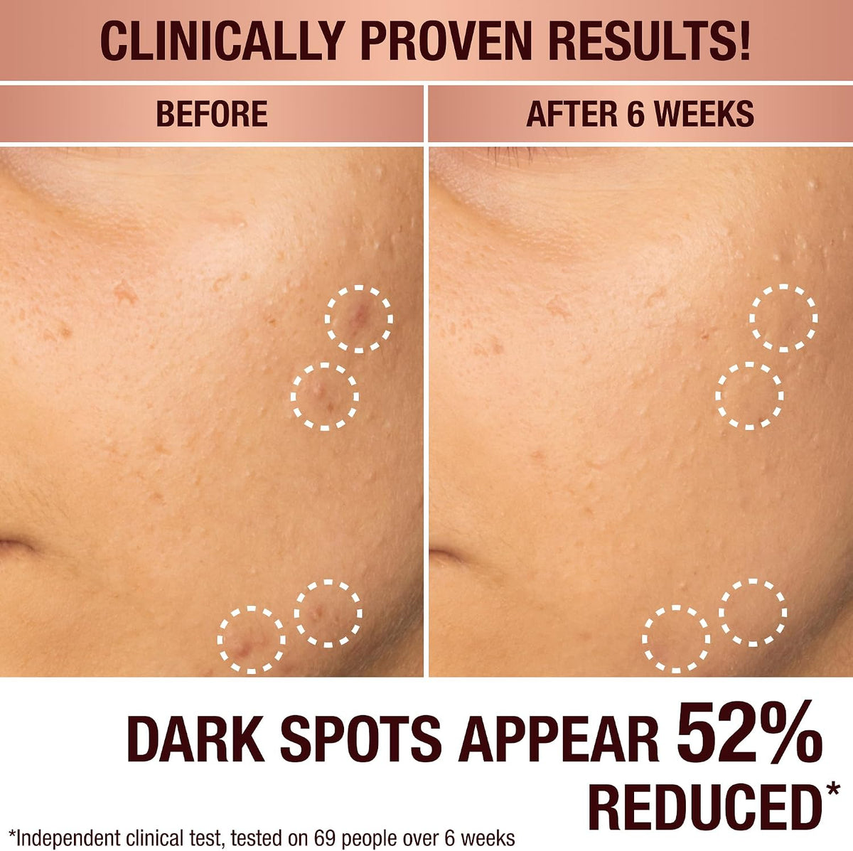 Charlotte Tilbury skincare serum for dark spots and redness