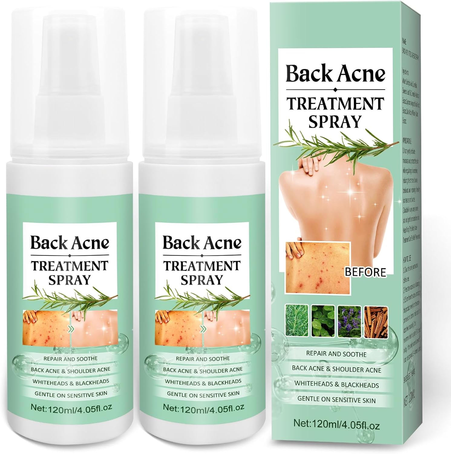 BEFIVECOK Back Acne Treatment Spray front view showcasing the two pack bottles