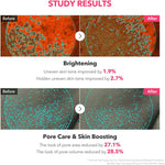 USA imported Aprilskin Toning Shot spicule serum product shot for dark spot care.