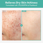 TOSOWOONG B5 Panthenol facial cream for sensitive skin calming care
