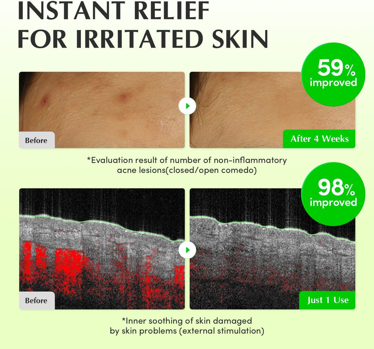 Eqqualberry Aloe Pdrn Calming Toner application method for sensitive skin
