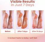 LuxaDerme callus remover foot mask application demonstration