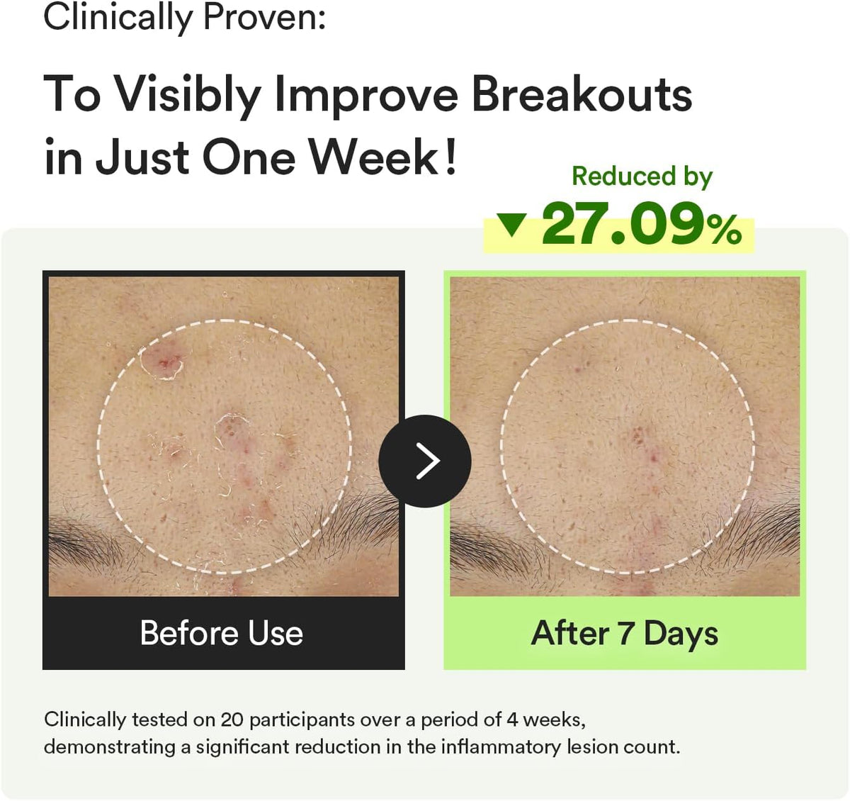Abib Centella Asiatica and Niacinamide serum for redness relief