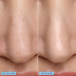 Close up of Bioré nose mask bubbling action
