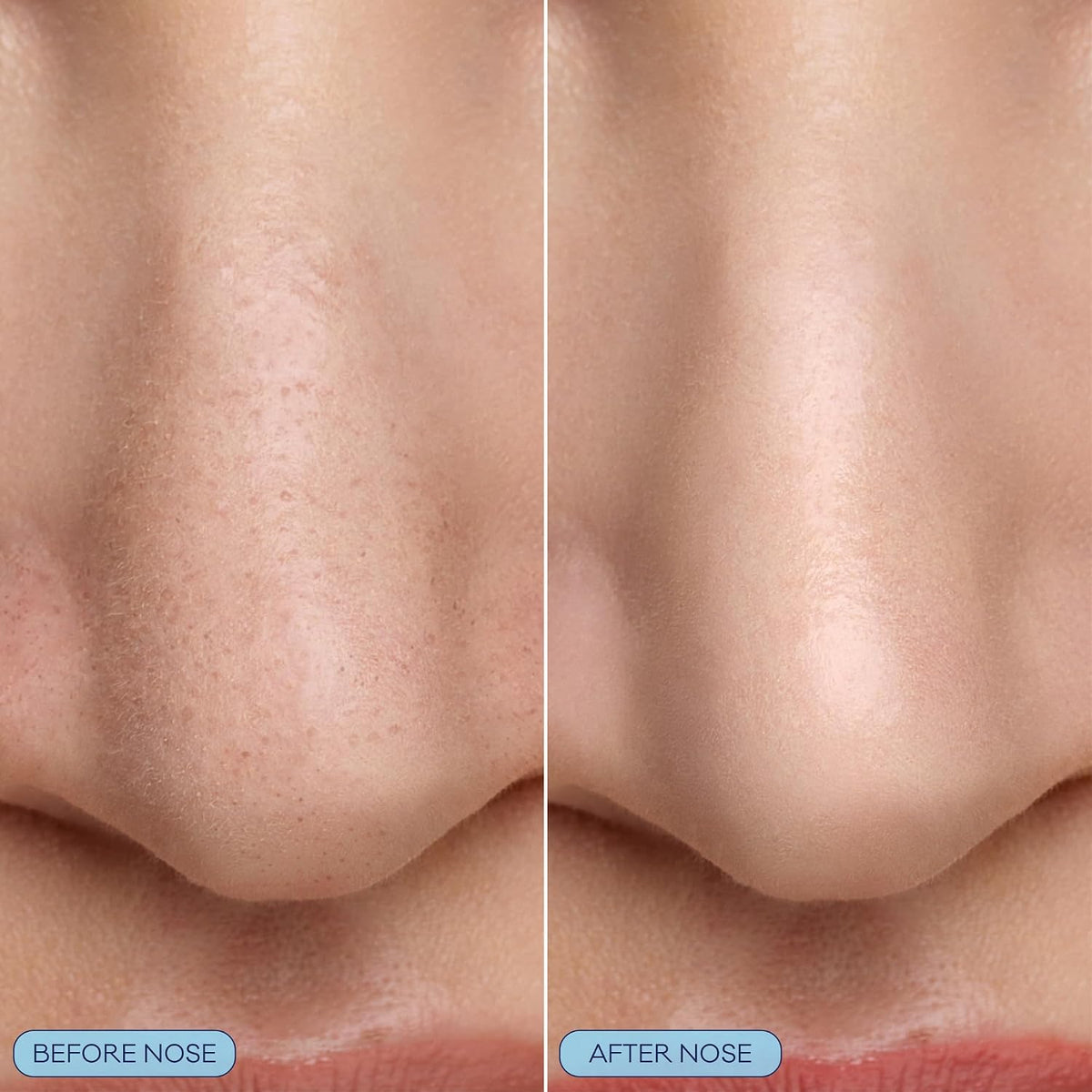 Close up of Bioré nose mask bubbling action