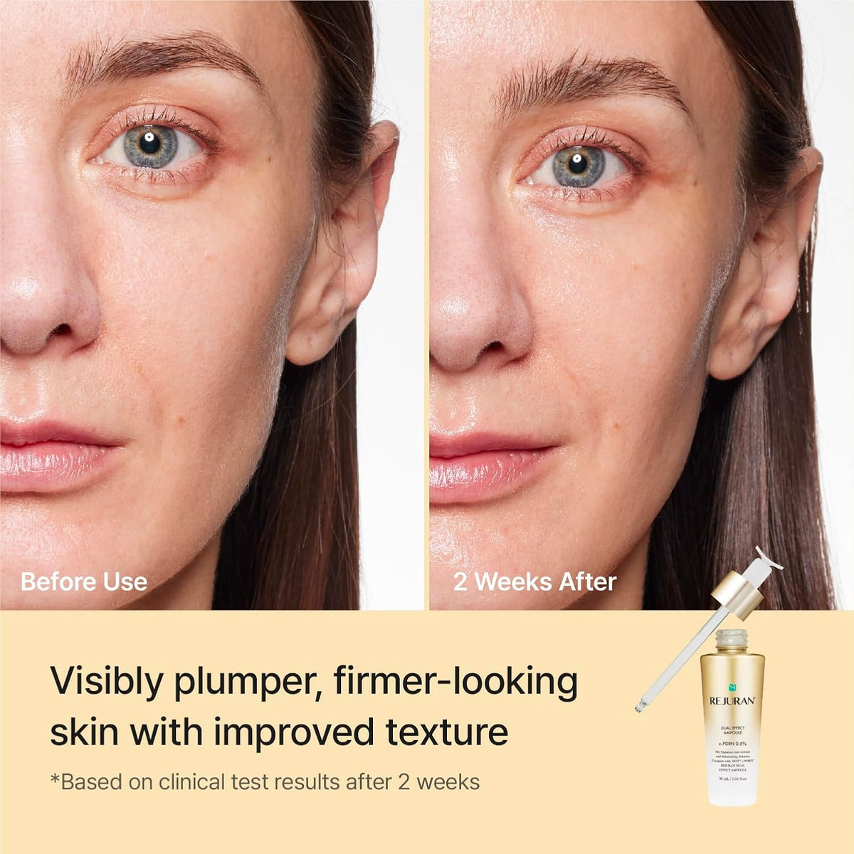 Rejuran ampoule applicator detail